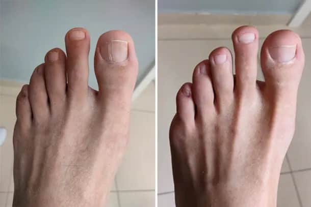 Pedicure podologiczny - więcej niż pielęgnacja. Dlaczego warto go wykonać?