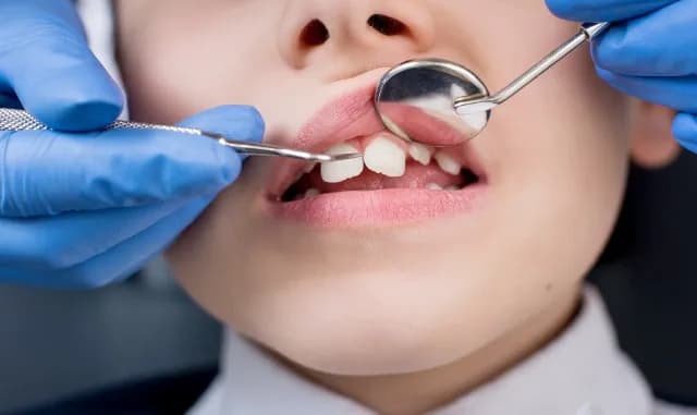 Stomatologia na NFZ co obejmuje? Sprawdź, co możesz zyskać!