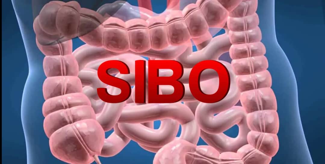 SIBO: przerost flory bakteryjnej i jego skutki dla zdrowia.