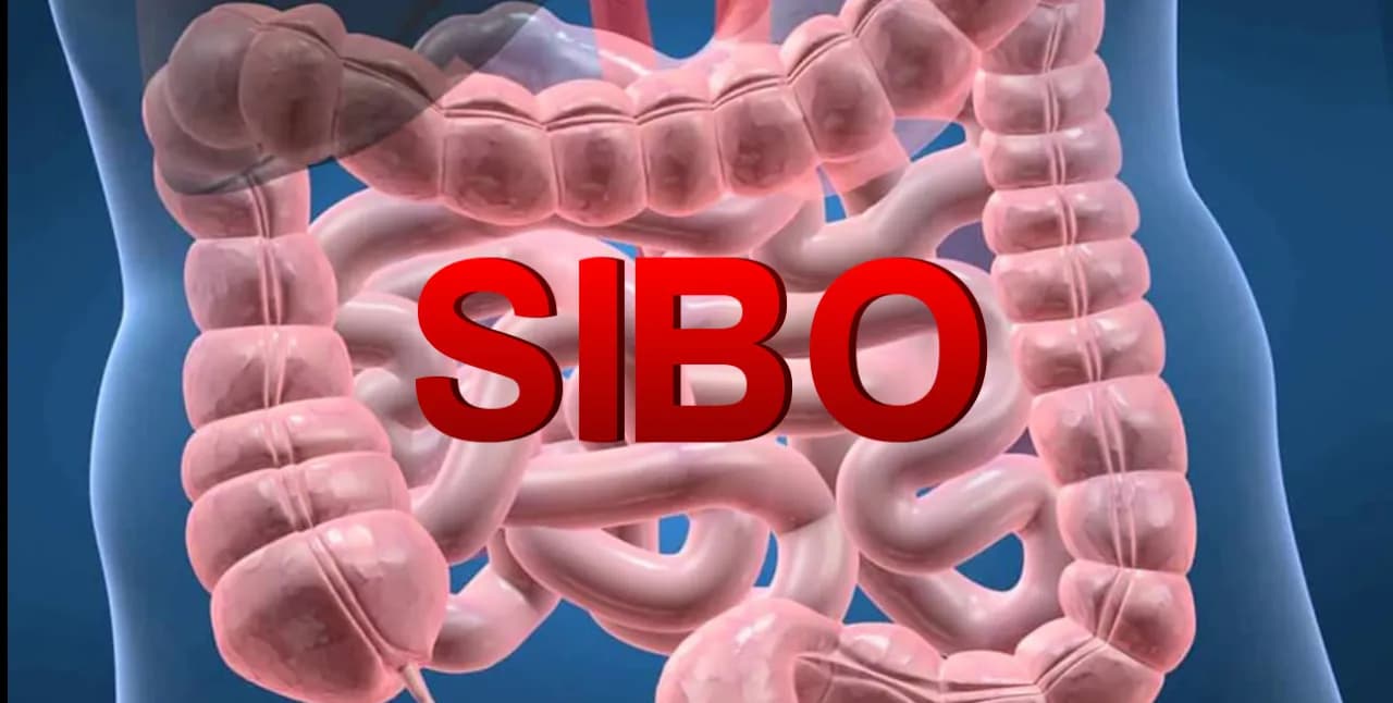 SIBO: przerost flory bakteryjnej i jego skutki dla zdrowia.