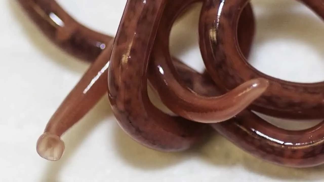 Pasożyty w ciele: 8 przerażających faktów i metody diagnostyczne