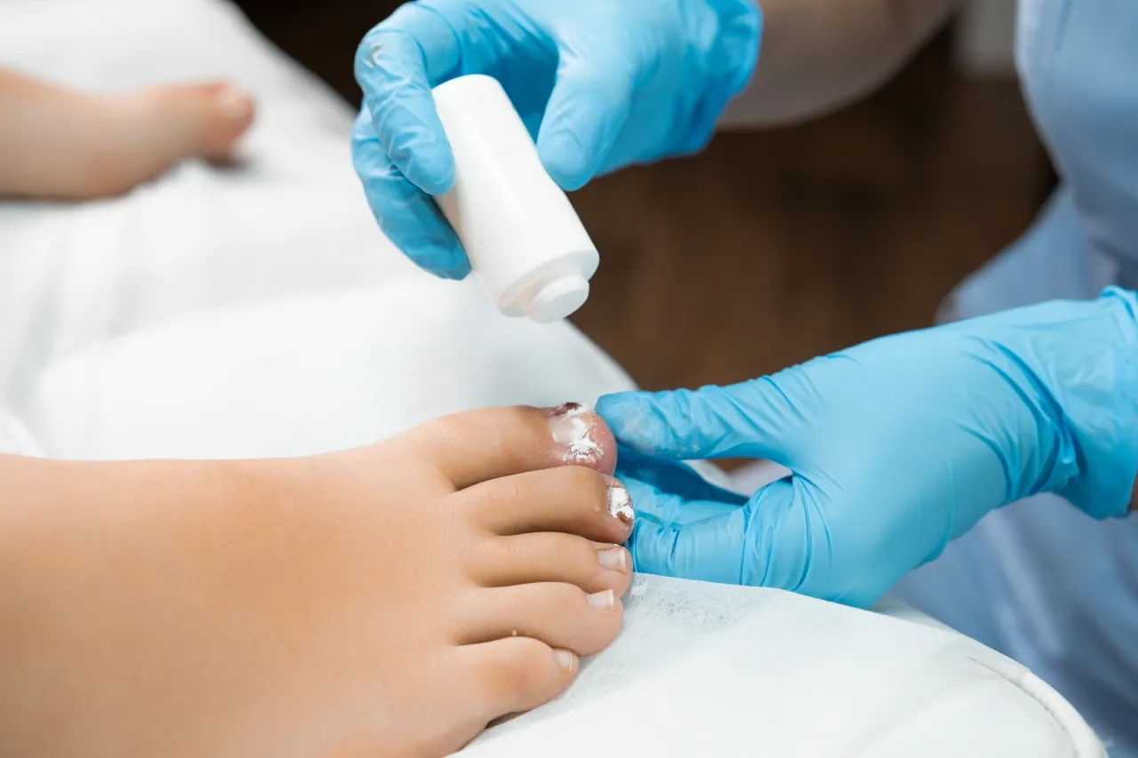 Pedicure podologiczny - więcej niż pielęgnacja. Dlaczego warto go wykonać?