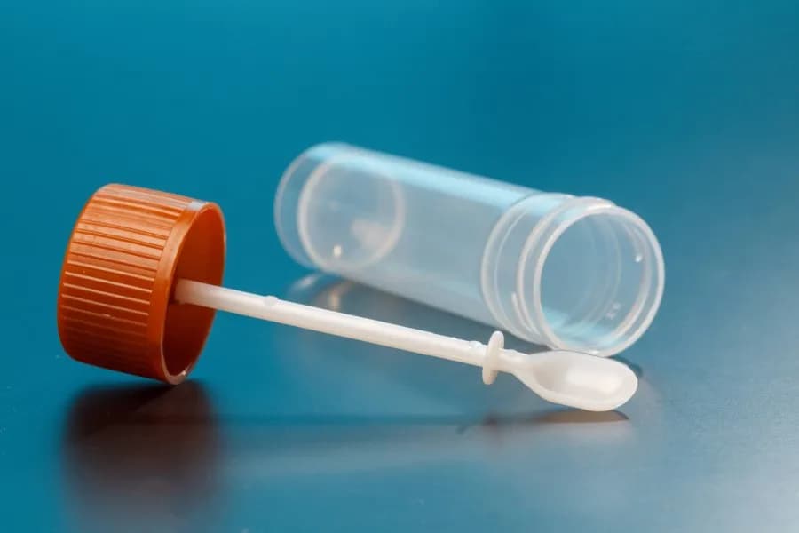 Czego nie jeść przed badaniem krwi utajonej w kale, aby uniknąć błędów