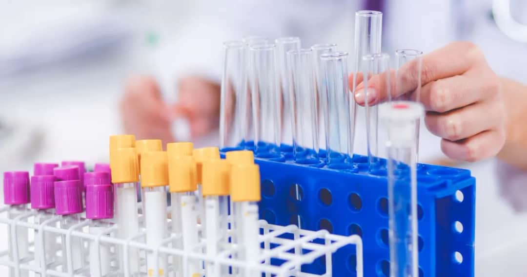 Co jeść dzień przed badaniem krwi, aby uniknąć błędnych wyników?