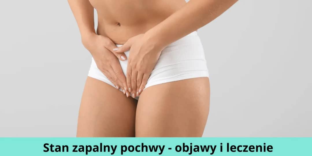 Stan zapalny pochwy: 5 głównych przyczyn i skuteczne leczenie