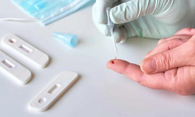 Badanie IgG - nieprawidłowy wynik i jego znaczenie