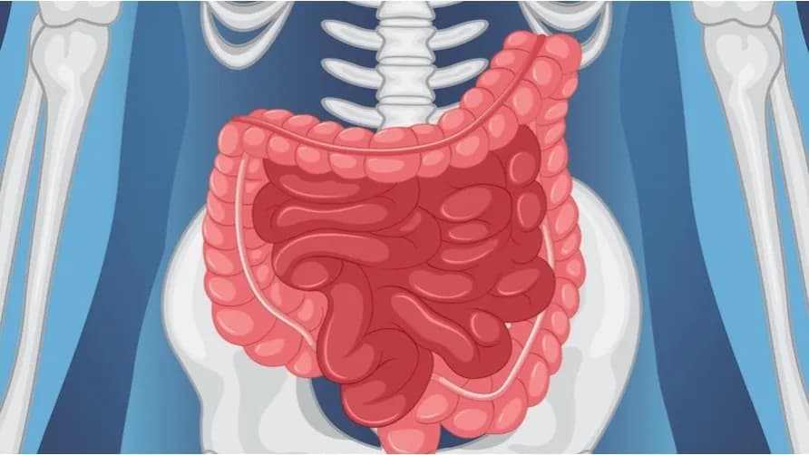 Czy rak jelita grubego jest dziedziczny? Sprawdź ryzyko w rodzinie
