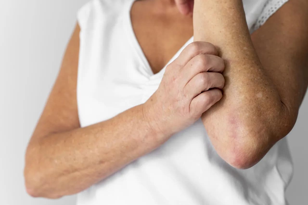 Skórne objawy pasożytów: 5 alarmujących zmian. Jak je rozpoznać?