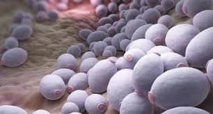 Candida - jakie objawy wskazują na zakażenie grzybicze?