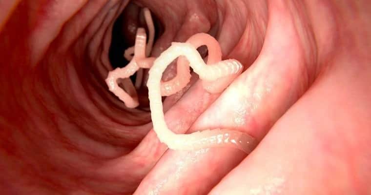 Bakteryjne i pasożytnicze choroby układu pokarmowego: Przegląd