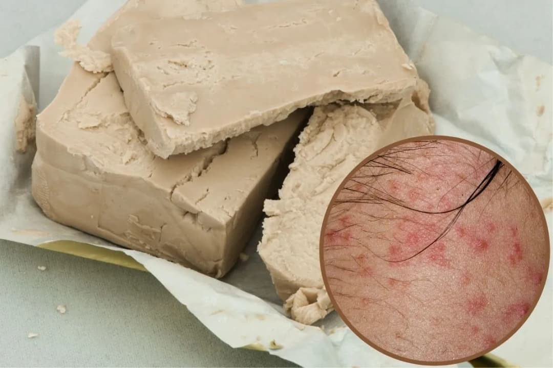 Nietolerancja drożdży i fruktozy: jak dostosować swoją dietę?