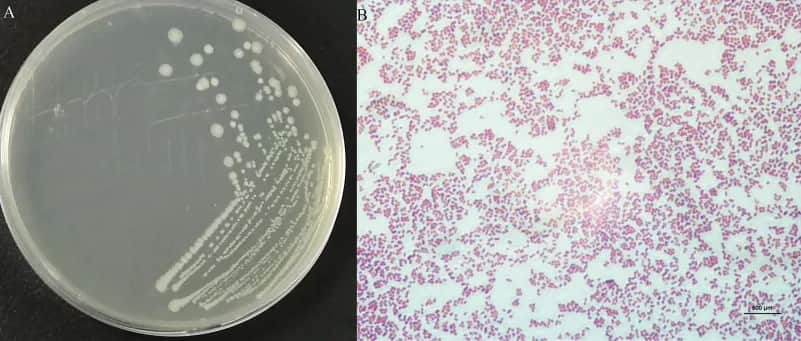 Morganella: objawy i metody leczenia tej niebezpiecznej bakterii.