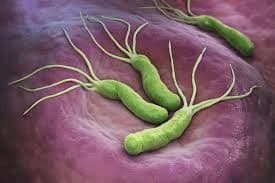 Helicobacter pylori - badania krwi i testy diagnostyczne