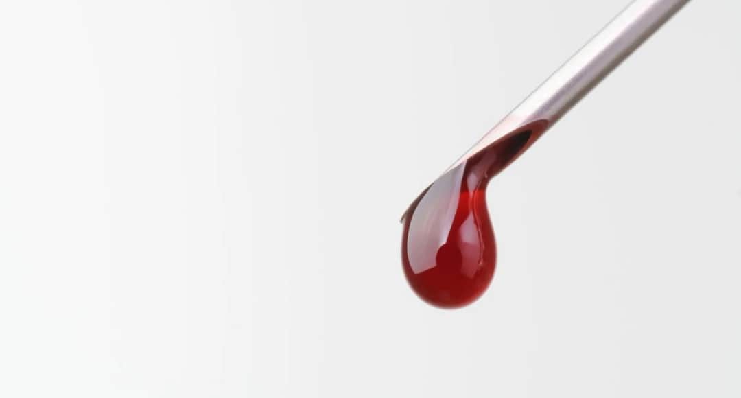 Badanie z kropli krwi - zastosowanie, opinie, przeciwwskazania