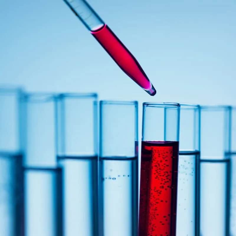 Ile jest ważne badanie kreatyniny przed rezonans? Kluczowe informacje