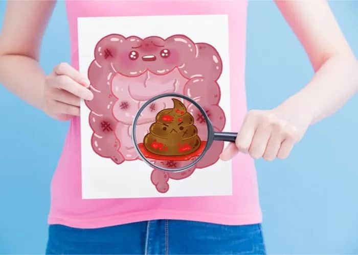 Krew utajona w kale: Co oznacza wynik dodatni? Pełna analiza