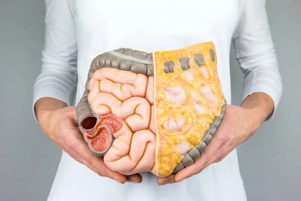 Lactobacillus plantarum 299v w terapii SIBO: Efekty i zastosowanie