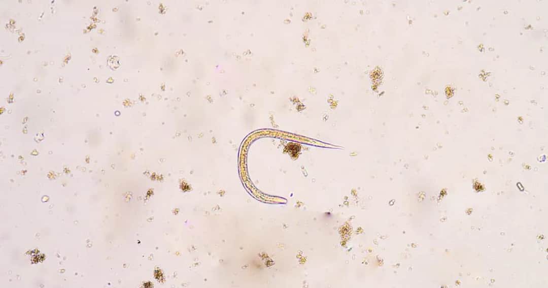 Pasożyty w ciele człowieka: Gdzie się ukrywają? Oto pełna mapa