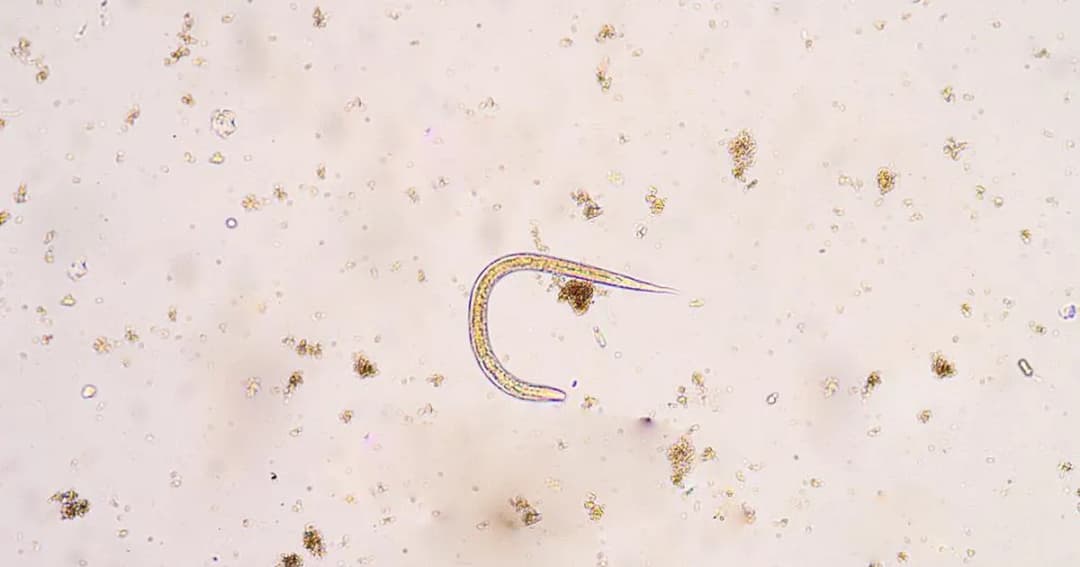 Pasożyty w ciele człowieka: Gdzie się ukrywają? Oto pełna mapa