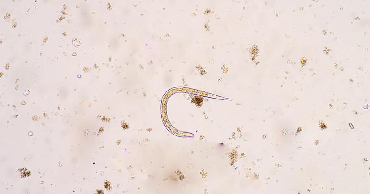 Pasożyty w ciele człowieka: Gdzie się ukrywają? Oto pełna mapa