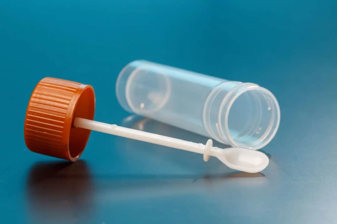 Czego unikać przed badaniem kału, aby wyniki były wiarygodne i dokładne