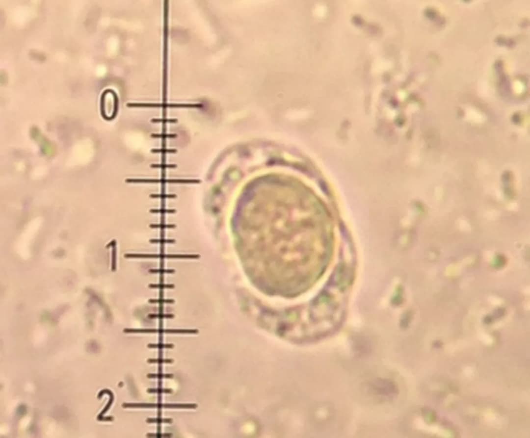 Blastocystis hominis - charakterystyka, objawy i naturalne leczenie