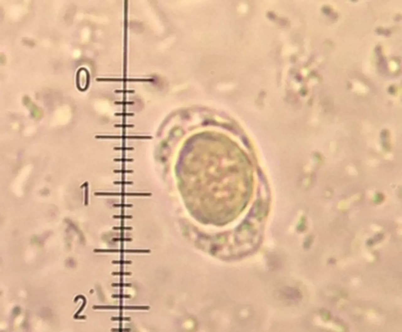 Blastocystis hominis - charakterystyka, objawy i naturalne leczenie