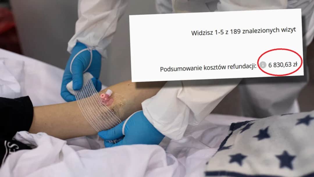 Jak sprawdzić ile nfz wydał na moje leczenie i uniknąć nieprzyjemnych niespodzianek