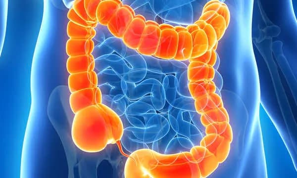 Przeszczep jelit: co warto wiedzieć przed zabiegiem?