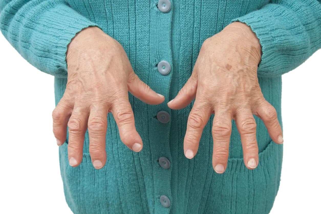 RZS - choroba autoimmunologiczna: objawy i opcje leczenia.