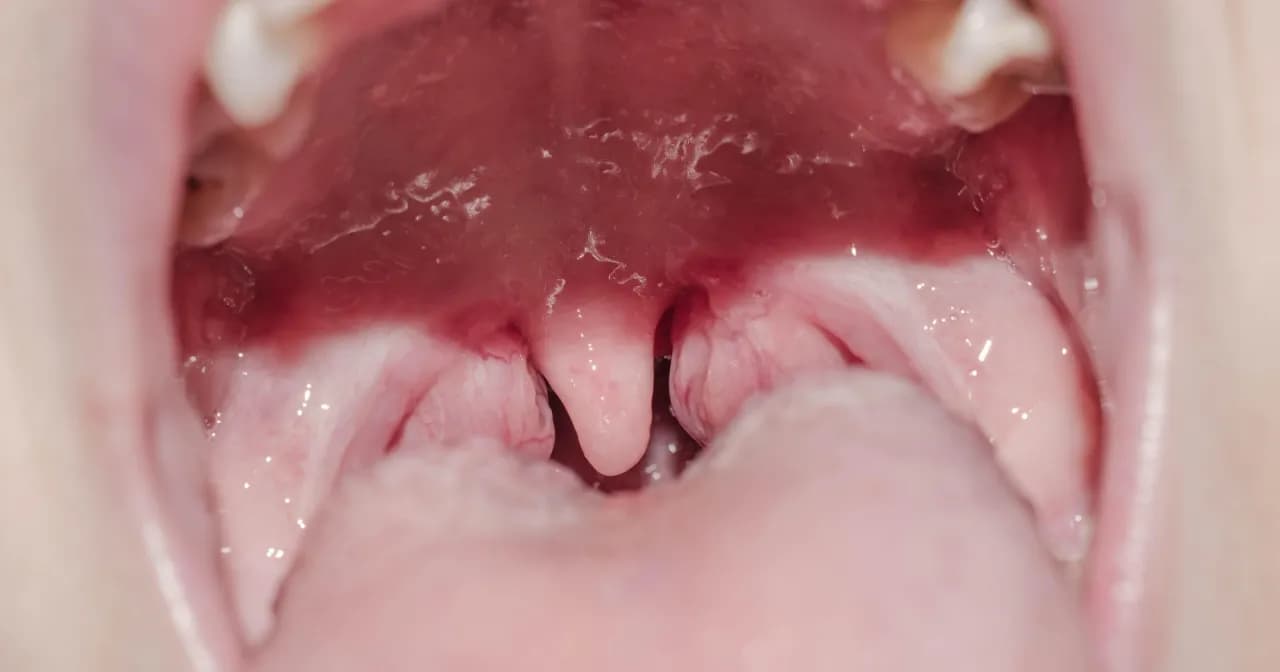 Jakie badania przed wycięciem migdałków? Kluczowe informacje i porady