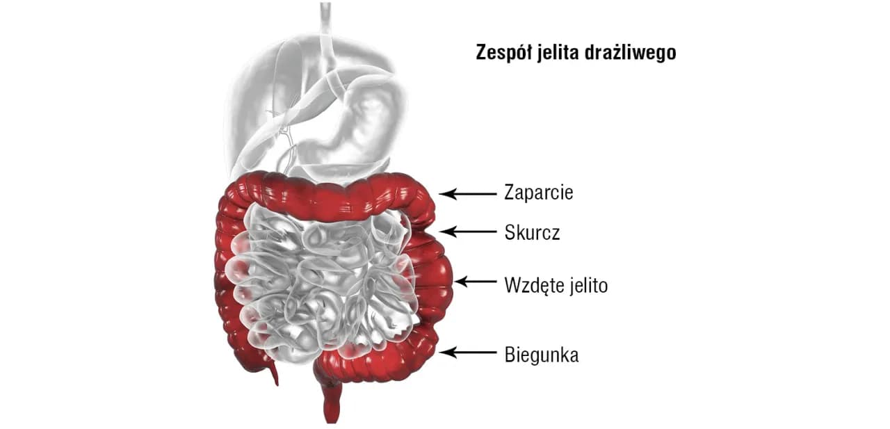 Jak długo trwa zespół jelita drażliwego? 5 kluczowych faktów
