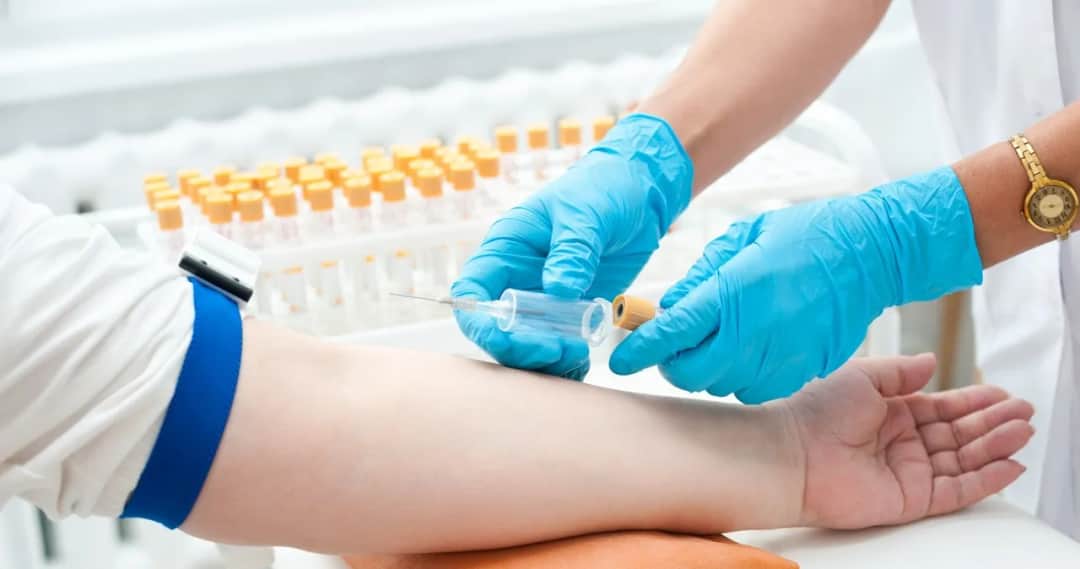 Czy można napić się wody przed badaniem krwi? Sprawdź, co musisz wiedzieć