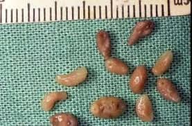 Jaja przywry w kale - jak rozpoznać obecność pasożytów jelitowych?