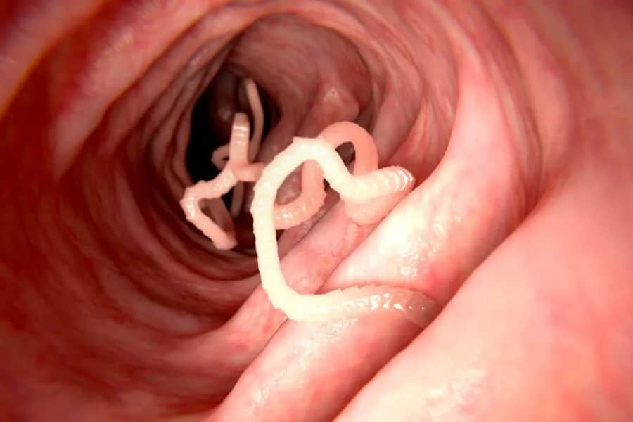 Pasożyty ludzkie: 7 szokujących faktów i zdjęć. Pełna analiza