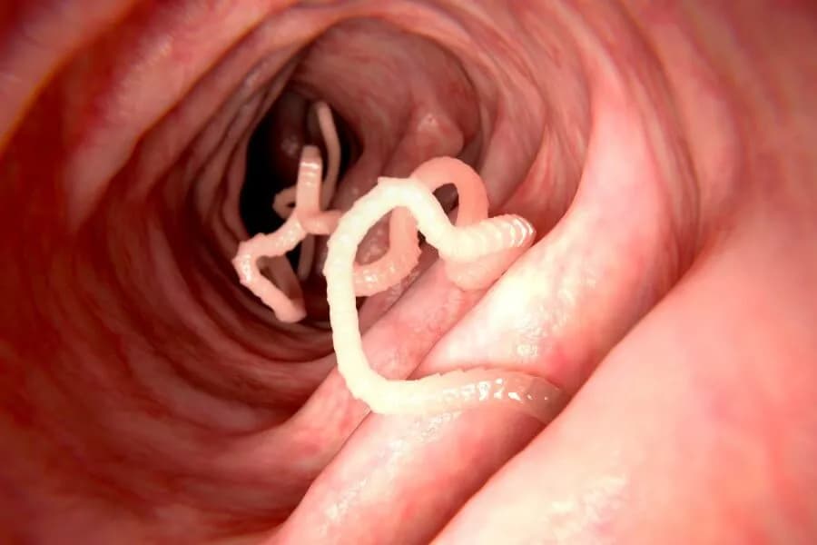 Pasożyty ludzkie: 7 szokujących faktów i zdjęć. Pełna analiza