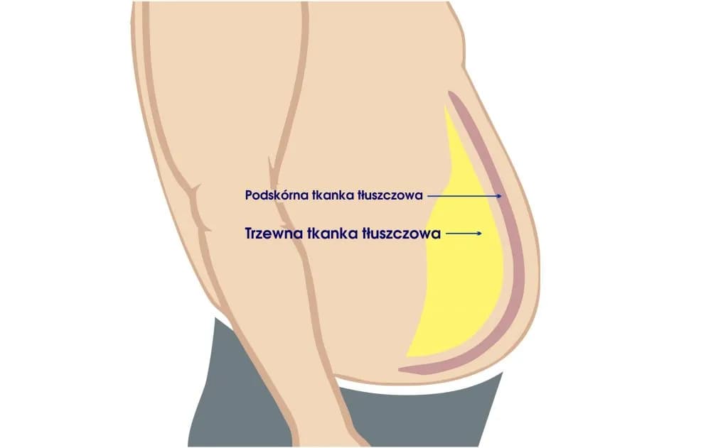 Tkanka tłuszczowa trzewna: Dlaczego jest tak niebezpieczna?