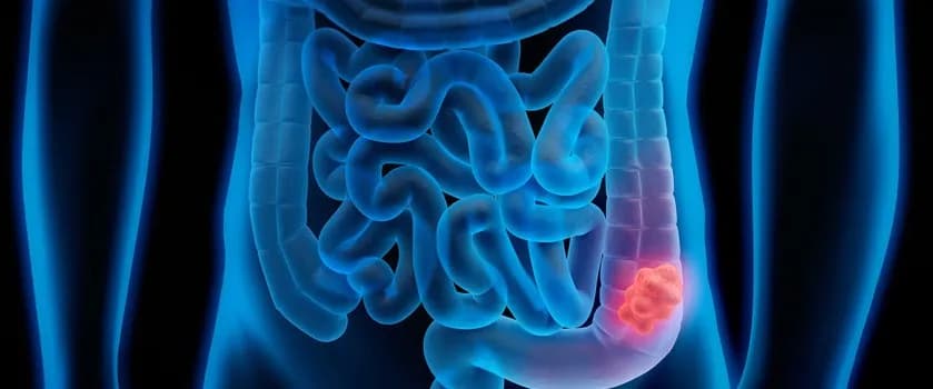 Czy jelita bolą? Odkryj prawdę o bólu jelit i jak sobie z nim radzić