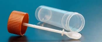 Badanie kału na pasożyty u dzieci - ważne informacje