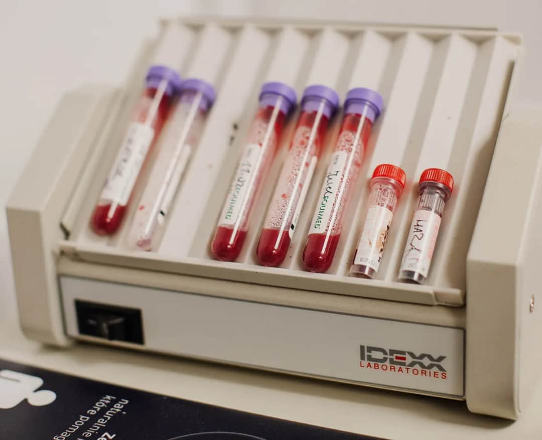 Czy żucie gumy przed badaniem krwi może zafałszować wyniki? Ważne informacje