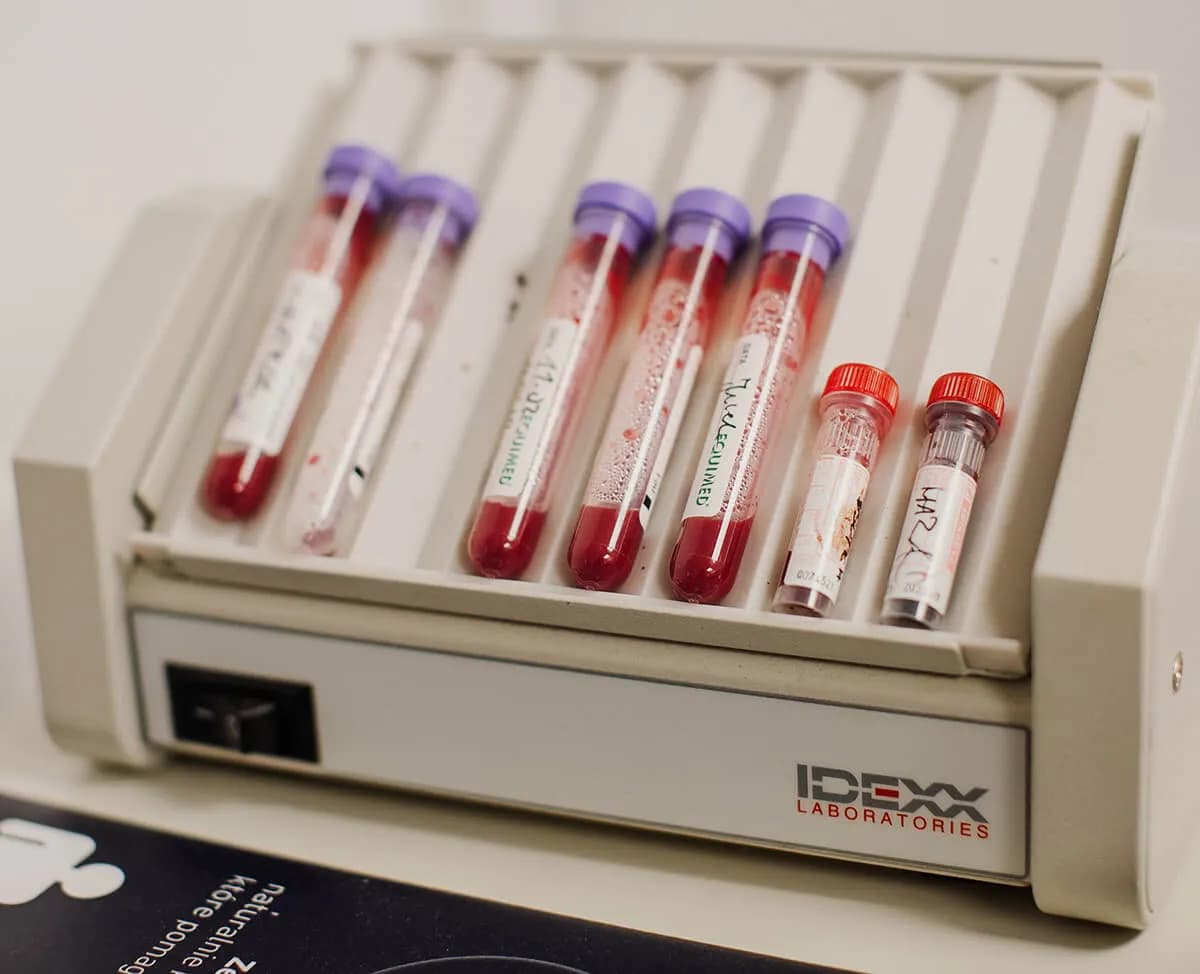 Czy żucie gumy przed badaniem krwi może zafałszować wyniki? Ważne informacje