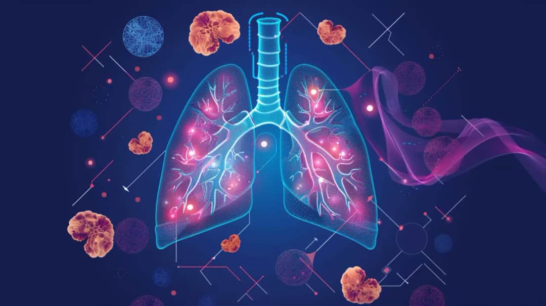 Sarkoidoza płuc: Jak ją rozpoznać i skutecznie leczyć? Poradnik